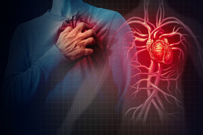 Pathologies cardio-vasculaires