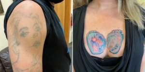 Insolite : voici les pires tatouages qui ne ressemblent vraiment à rien