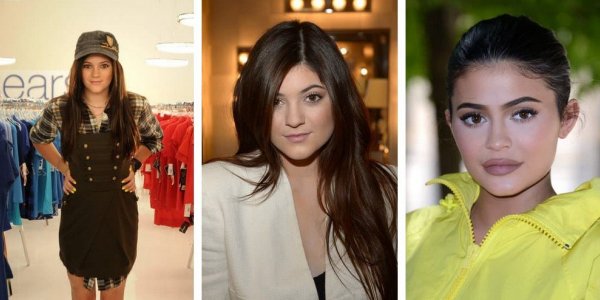 Kylie Jenner fête ses 24 ans : retour sur son impressionnante métamorphose physique